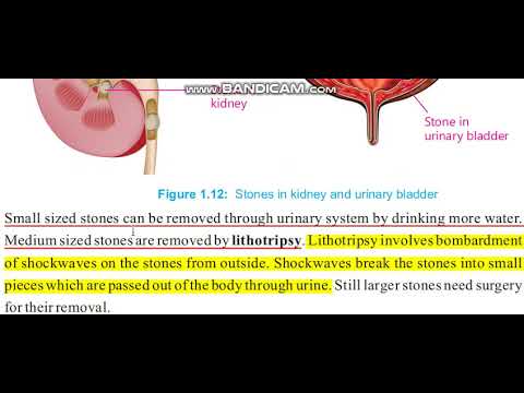 Class 8 Science Ch 01(Malfunctioning of kidneys , Stone formation in Kidneys) | Video