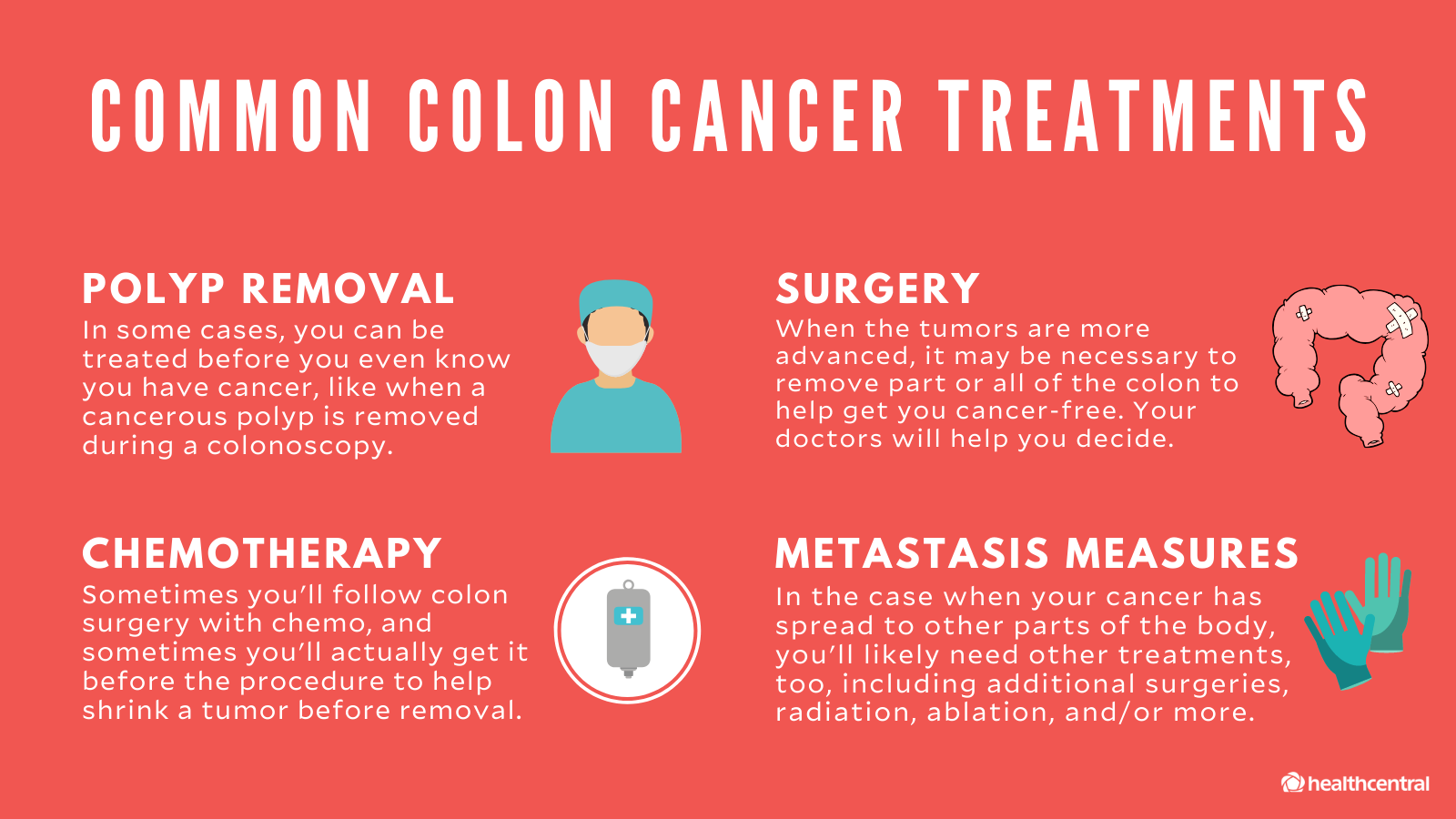 Do You Need a Colonoscopy to Prevent Colon Cancer? Ponirevo