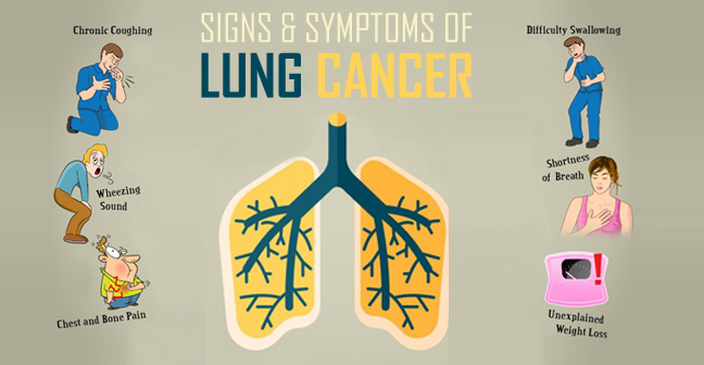early signs of lung cancer